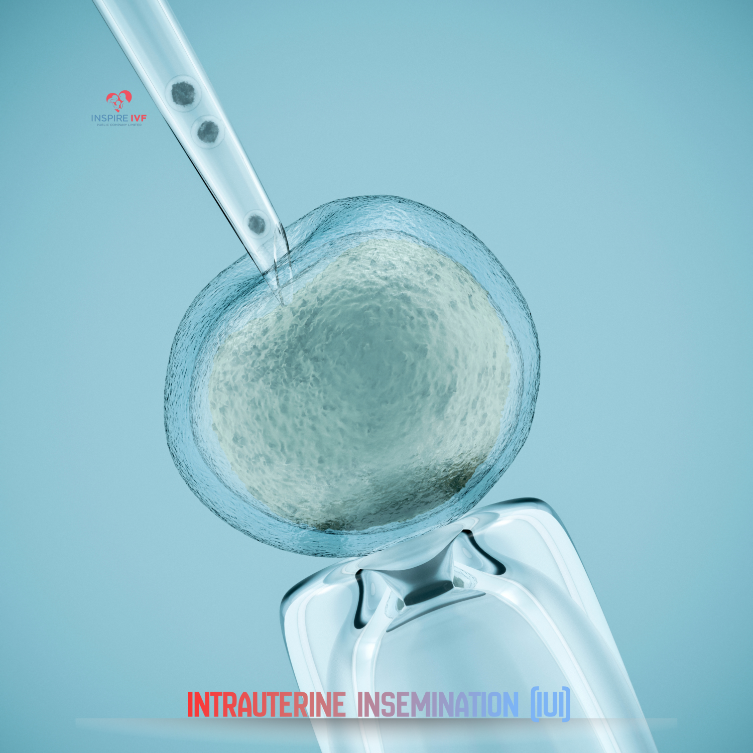 Intrauterine Insemination (IUI)