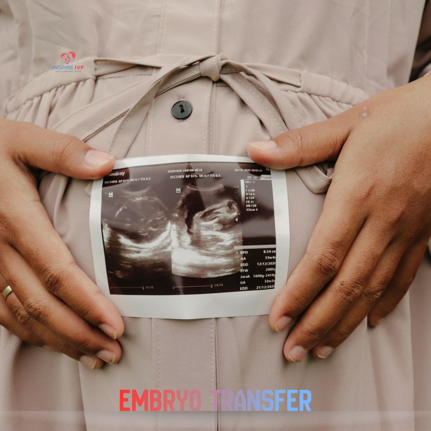 Embryo Transfer