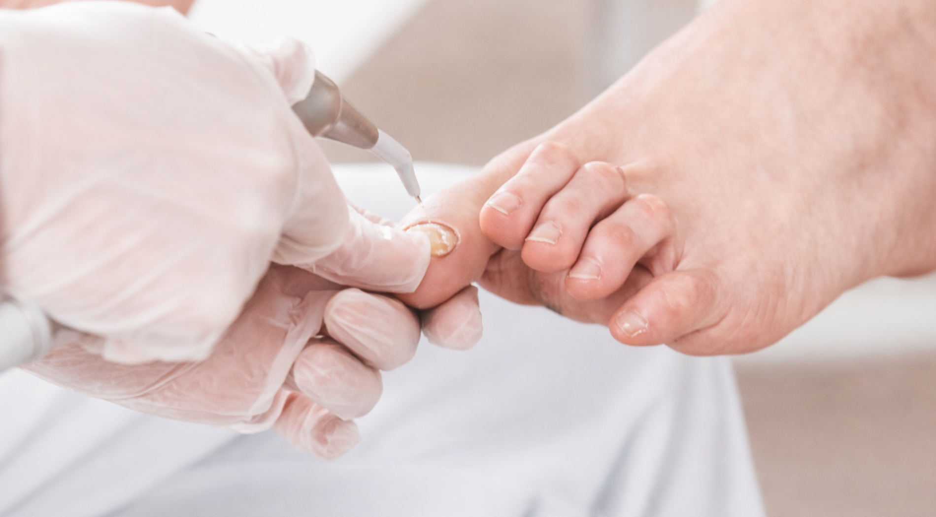 Wound Management Treatments