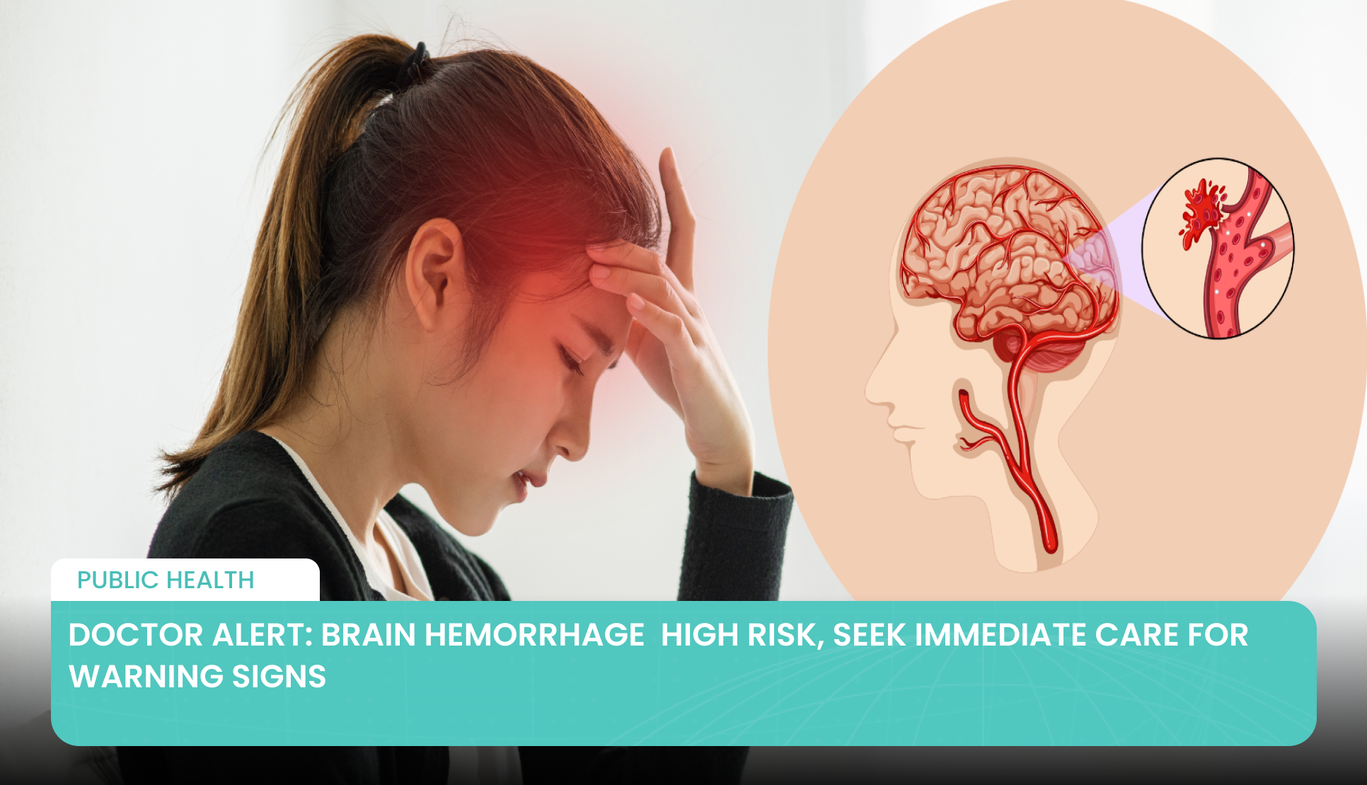 Doctor Alert: Brain Hemorrhage High Risk, Seek Immediate Care for ...