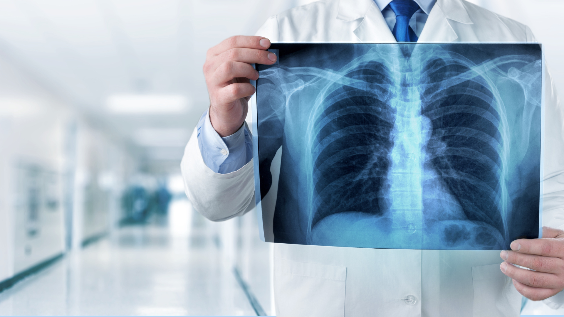 5 Behandlungen, um Lungenkrebs zu stoppen, bevor er sich ausbreitet