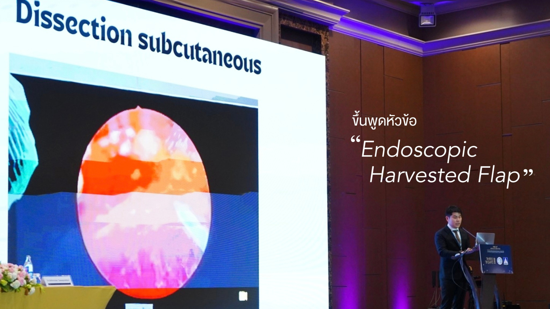 Доктор Бхакобхоб из больницы IDL выступает на конференциях ThPRS и ThSAPPS 2024 с докладом об эндоскопически забранном лоскуте.