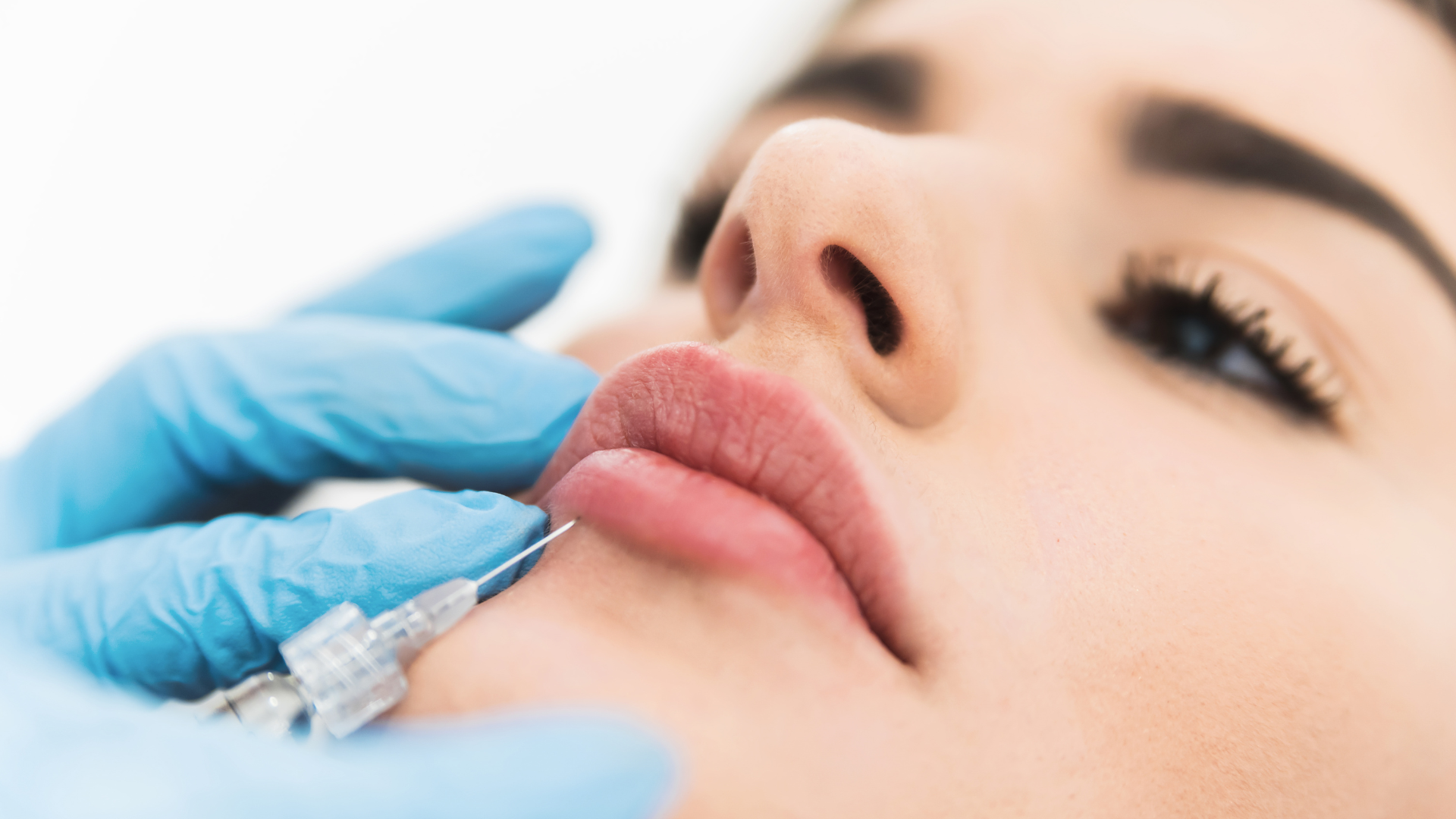 Can Thin Lips Get Lip Fillers? | ArokaGO
