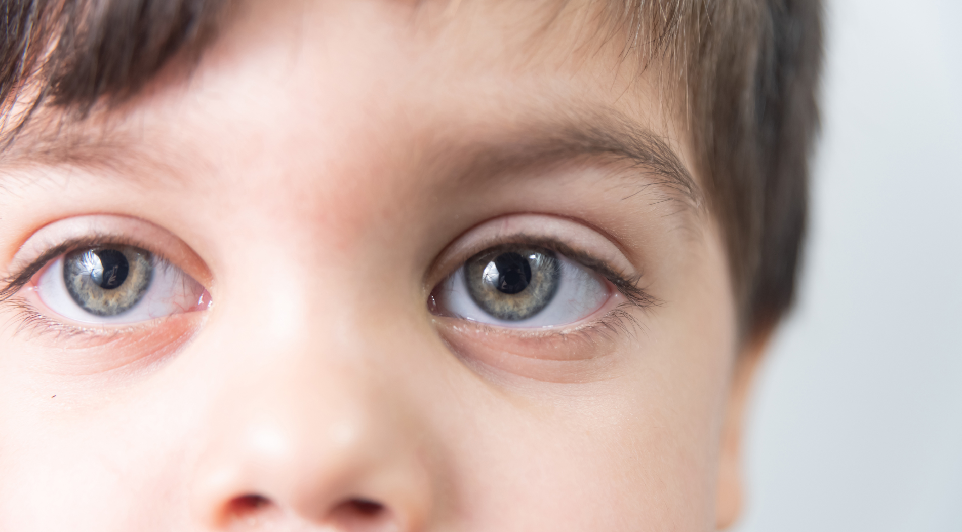 Strabismus Treatment Service