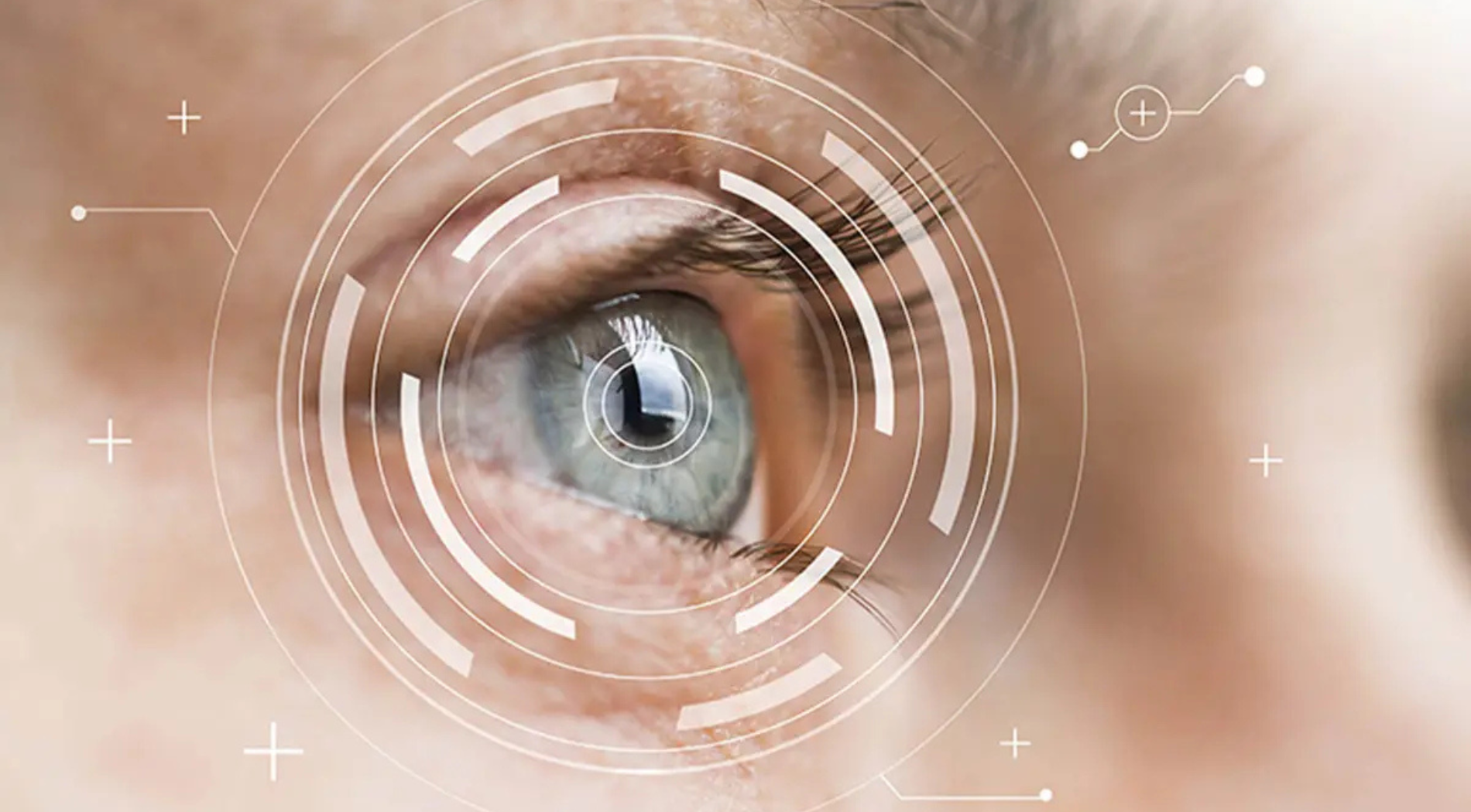 Implantable Collamer Lens (ICL) Service