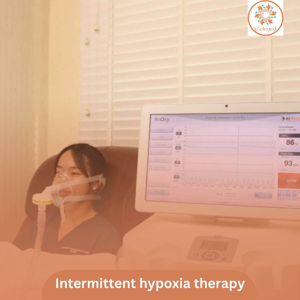 Terapi hipoksia intermiten