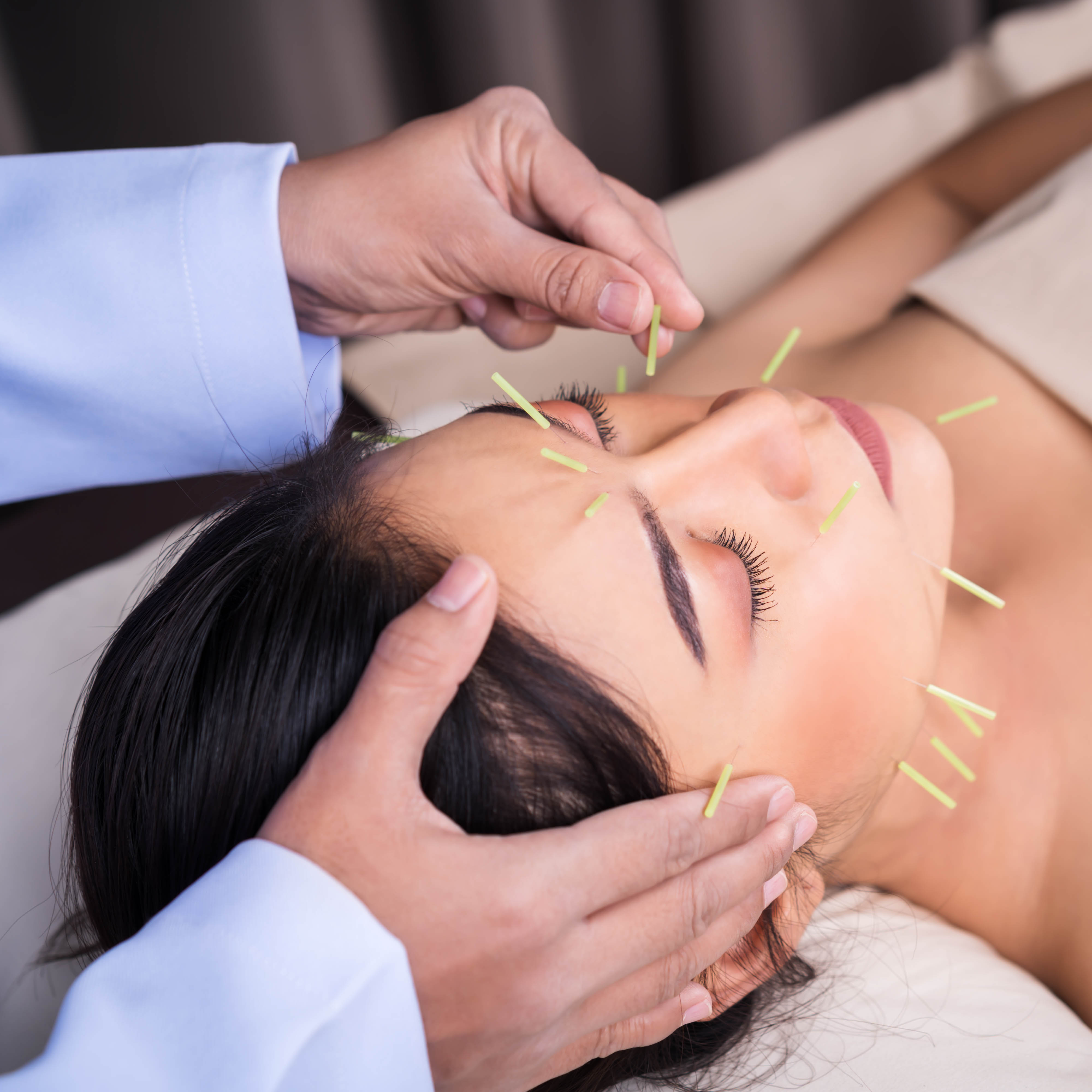 Discover the Natural Beauty of Acupuncture for Acne Treatment